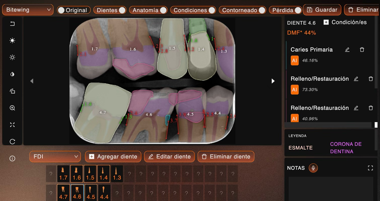 Análisis IA Bitwing