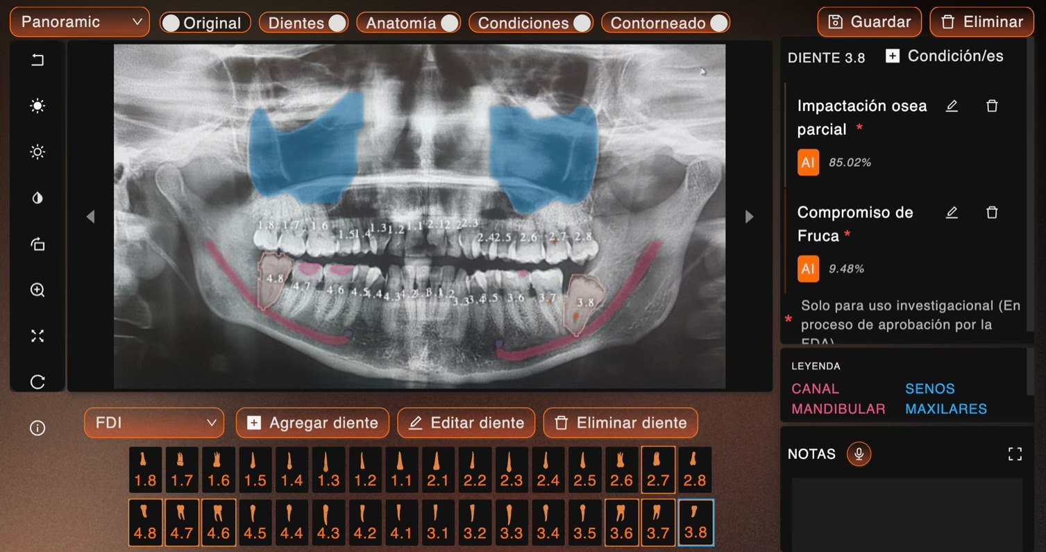Análisis IA Panorámica