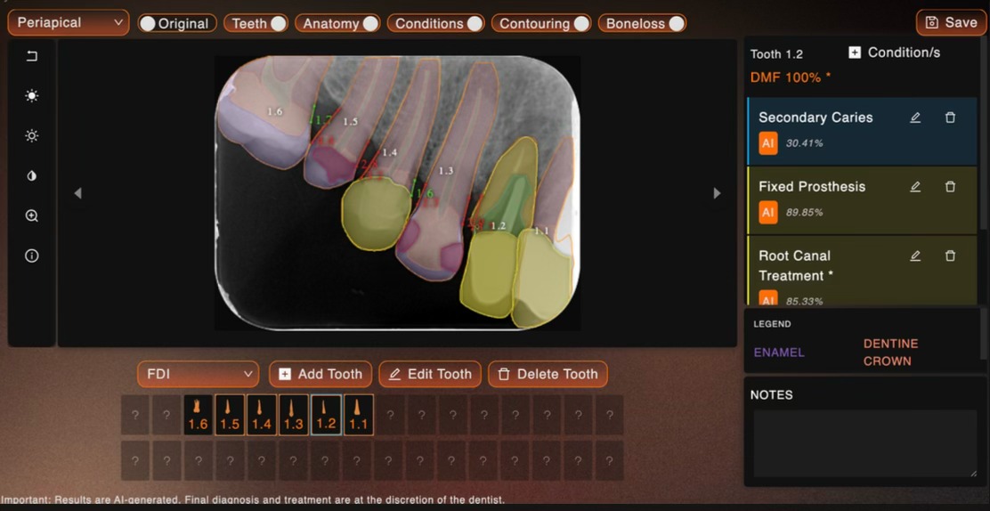 Análisis IA Detalle